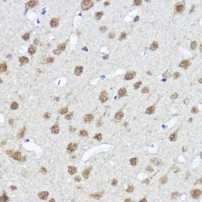 Immunohistochemistry-Paraffin: Myocardin Antibody - Azide and BSA Free [NBP2-93064]